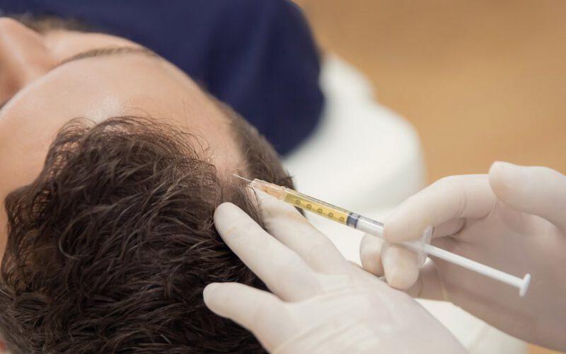 Mezoterapia włosów lub skóry głowy prp: procedura osocza bogatopłytkowego. Kosmetyczka lekarz wykonuje zastrzyki w głowie mężczyzny do wzrostu włosów, aby zapobiec